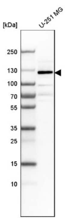 Lgl1 Antibody, Novus Biologicals 25 &mu;L; Unlabeled:Antibodies, Polyclonal
